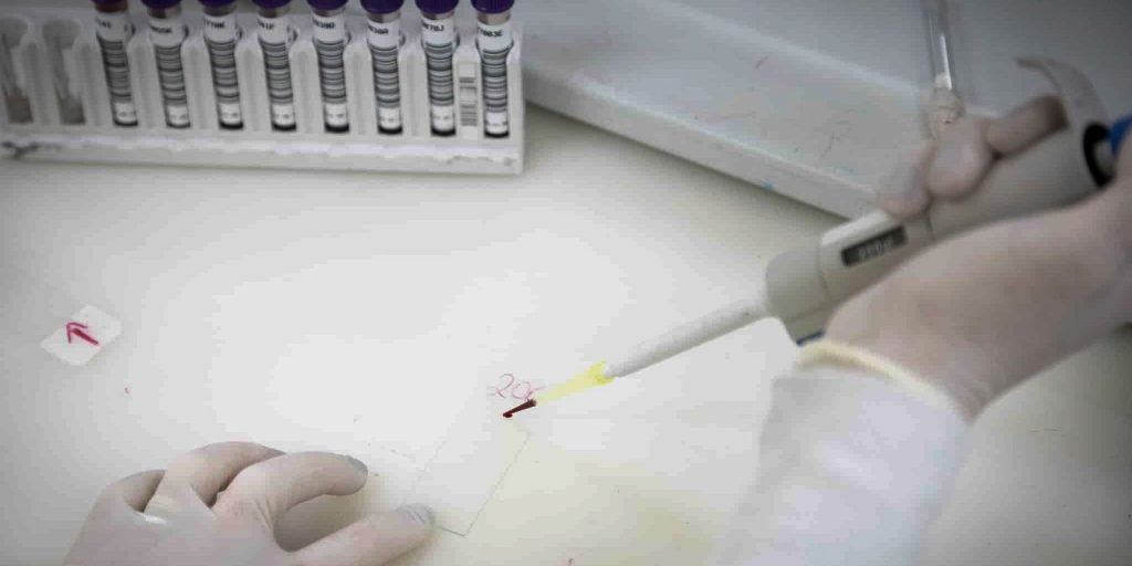 SP investiga segundo caso suspeito de ebola em paciente vinda do Congo