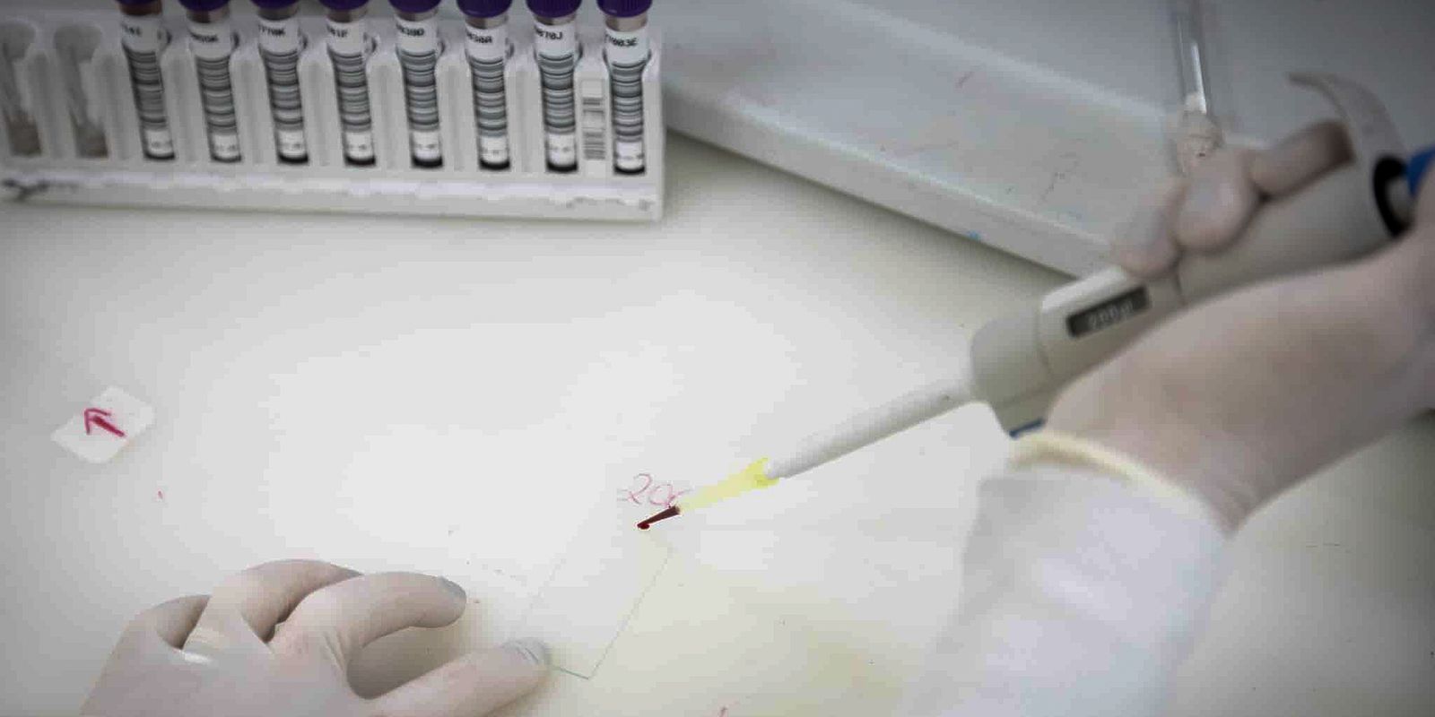 SP investiga segundo caso suspeito de ebola em paciente vinda do Congo