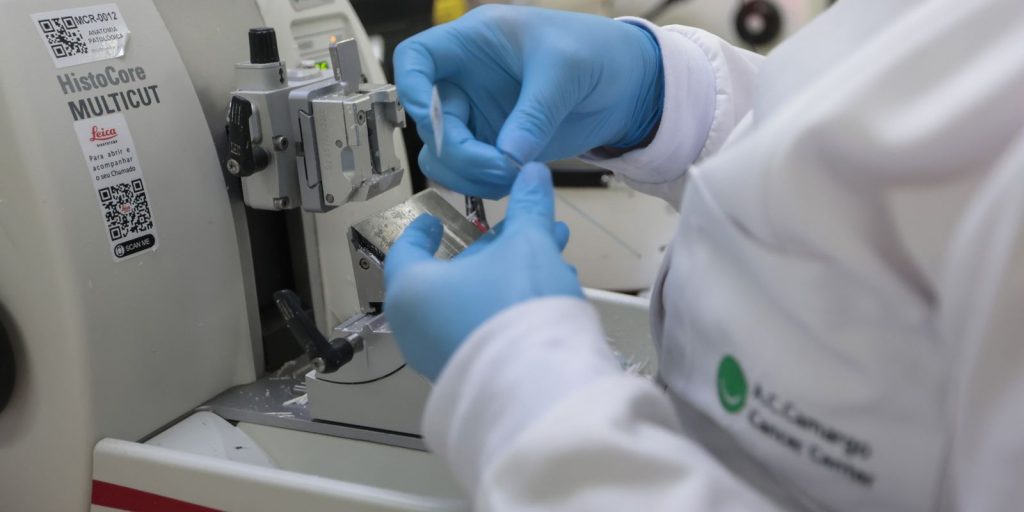 SUS incorpora novo tratamento para leucemia mieloide em adultos