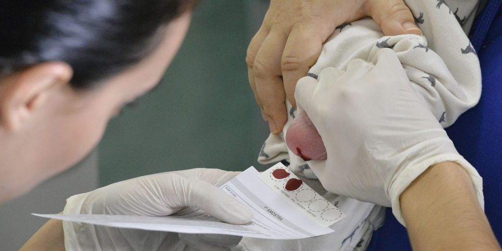 Diagnóstico tardio da AME compromete recuperação de pacientes