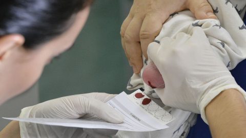 Diagnóstico tardio da AME compromete recuperação de pacientes