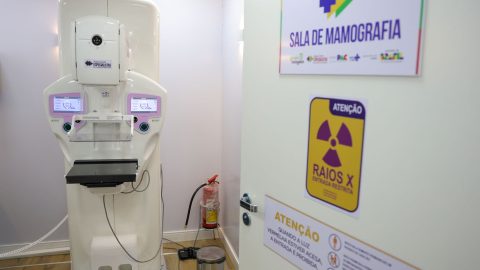Cirurgias de mama no SUS mais que dobram em uma década